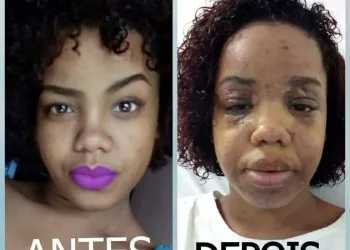 PANELA DE PRESSÃO QUASE MATA MULHER!!!! (FOTOS)