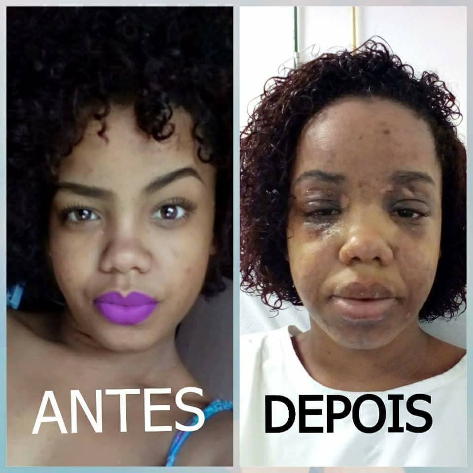 PANELA DE PRESSÃO QUASE MATA MULHER!!!! (FOTOS)
