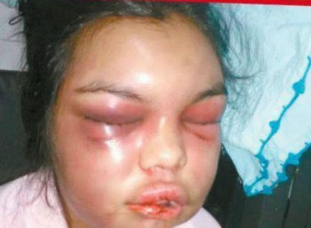 Marido bate em mulher por cada “like” que ela recebeu no Facebook