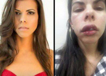 O PAÍS DA IMPUNIDADE, HOMEM AGRIDE A NAMORADA, PAGA APENAS UMA FIANÇA E ESTÁ EM LIBERDADE