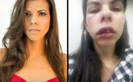 O PAÍS DA IMPUNIDADE, HOMEM AGRIDE A NAMORADA, PAGA APENAS UMA FIANÇA E ESTÁ EM LIBERDADE