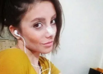 MULHER FAZ 50 CIRURGIAS PARA FICAR IGUAL A ANGELINA JOLIE!!!! O RESULTADO? VEJA AQUI….