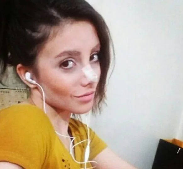 MULHER FAZ 50 CIRURGIAS PARA FICAR IGUAL A ANGELINA JOLIE!!!! O RESULTADO? VEJA AQUI….