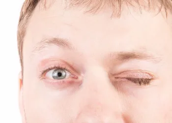 Homem perde a visão de um olho após ter um orgasmo muito forte