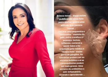 APRESENTADORA DA GLOBO EXPREME ESPINHA E SE DA MAL….