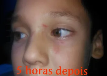 ALUNO É AGREDIDO EM ESCOLA NUM BAIRRO DA ZONA OESTE!!! MÃE SE REVOLTA!! (FOTOS)