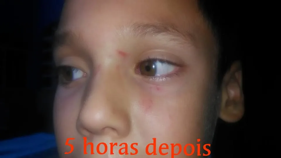 ALUNO É AGREDIDO EM ESCOLA NUM BAIRRO DA ZONA OESTE!!! MÃE SE REVOLTA!! (FOTOS)