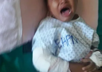 AJUDA URGENTE, PARA DIMINUIR O SOFRIMENTO DESSA CRIANÇA!!!