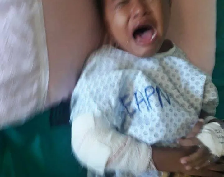 AJUDA URGENTE, PARA DIMINUIR O SOFRIMENTO DESSA CRIANÇA!!!