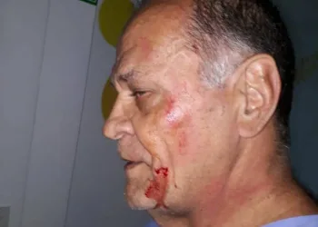 COVARDIA!!!MÉDICO É AGREDIDO NUMA UPA EM CAMPO GRANDE!!!