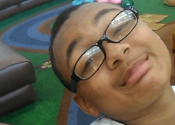 Menino de 13 anos morre por SINUSITE que foi para o cérebro