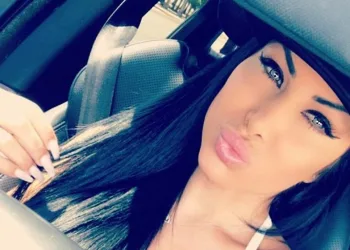 “Perdi a visão pra sempre”, diz modelo após mudar a cor dos olhos