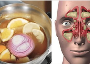 VOCÊ TEM SINUSITE? RENITE? SEUS PROBLEMAS ACABARAM….LEIA!!