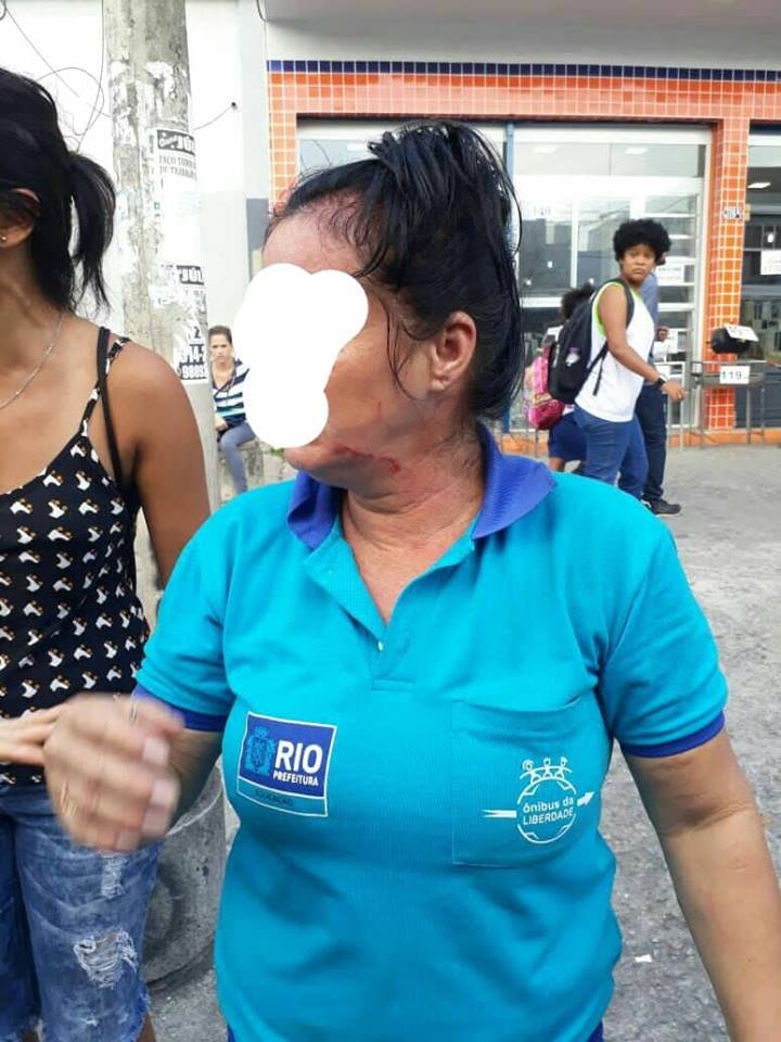 AGRESSÃO E COVARDIA EM CAMPO GRANDE!! FUNCIONÁRIA DO ÔNIBUS DA LIBERDADE É AGREDIDA!!(FOTOS)