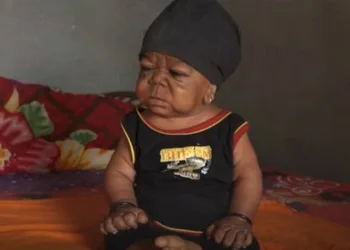 Homem de 23 anos vive preso em corpo de bebê