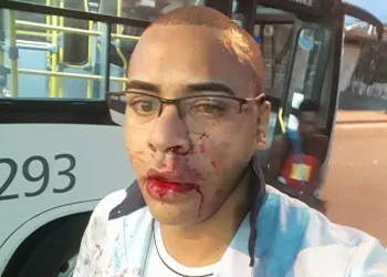 MOTORISTA DE ÔNIBUS É AGREDIDO COVARDMENTE EM CAMPO GRANDE!