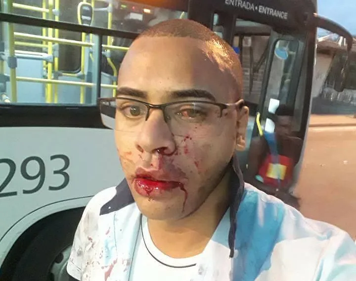 MOTORISTA DE ÔNIBUS É AGREDIDO COVARDMENTE EM CAMPO GRANDE!