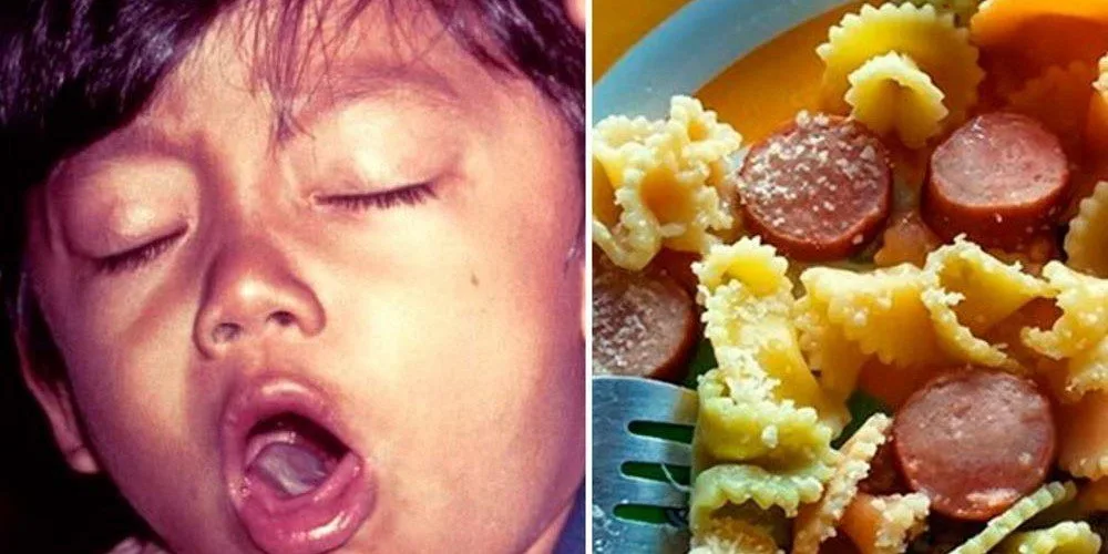 Estudo confirma que salsichas estão matando crianças há décadas, mas ninguém divulga