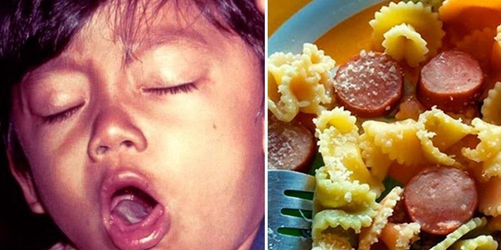 Estudo confirma que salsichas estão matando crianças há décadas, mas ninguém divulga