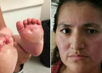 Babá “frita” pés de bebê de 6 meses, e o motivo REVOLTA!!!