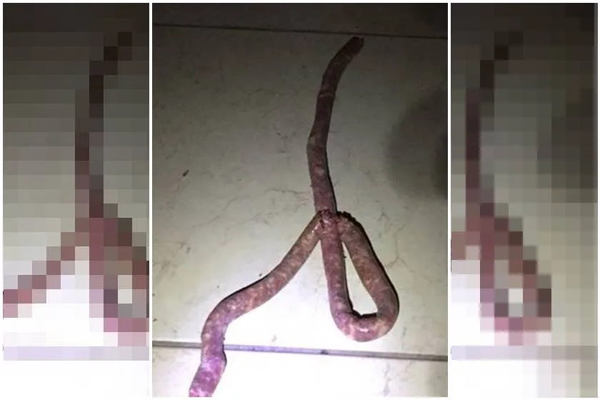 Mulher confunde linguiça com cobra e pede socorro a bombeiros