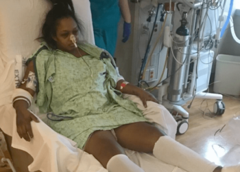 Mulher Perde Útero Depois de DIU Migrar para Estômago e Fígado