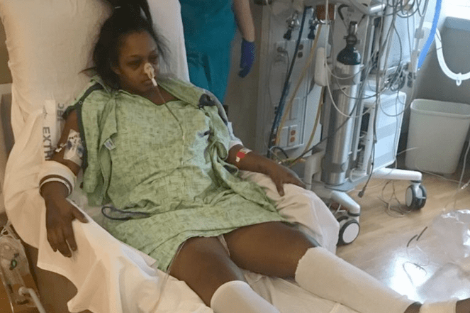 Mulher Perde Útero Depois de DIU Migrar para Estômago e Fígado