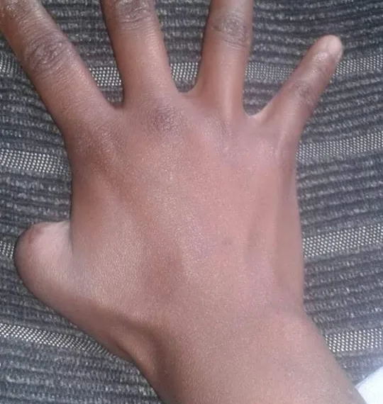 ELA TINHA O HÁBITO DE ROER AS UNHAS…E O PIOR ACONTECEU.