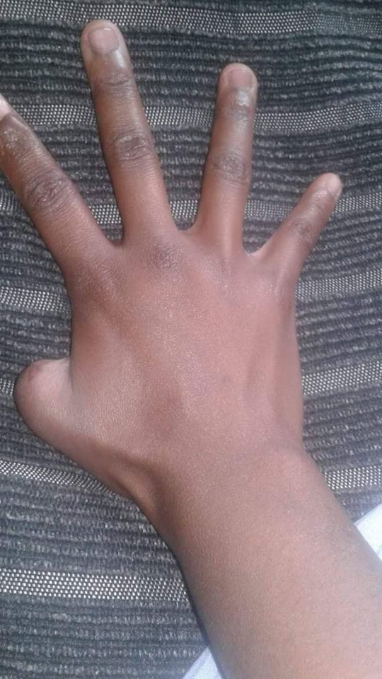 ELA TINHA O HÁBITO DE ROER AS UNHAS…E O PIOR ACONTECEU.