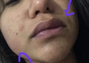 AGREDIDA POR HOMEM?? BASTA!!! CHEGA!!! LEIA…