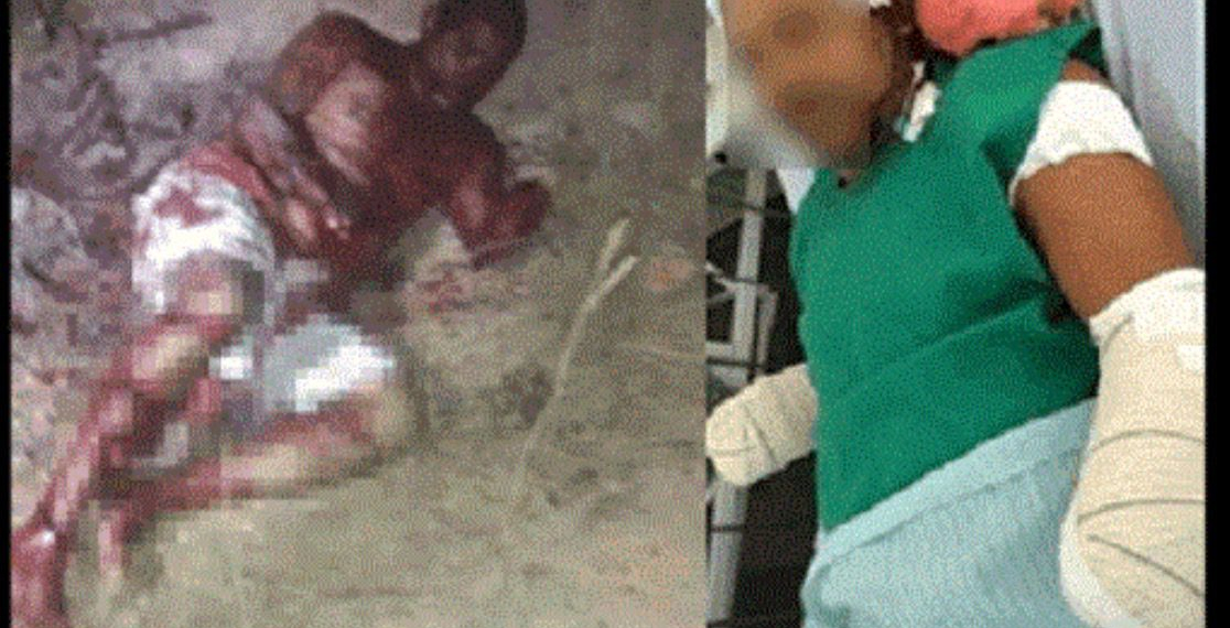 Estuprador de bebê de apenas 7 meses tem as duas mãos decepadas pelo pai da vítima