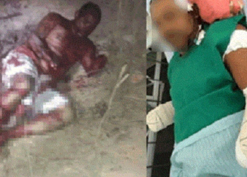 Estuprador de bebê de apenas 7 meses tem as duas mãos decepadas pelo pai da vítima