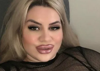 Modelo faz cirurgia para ter bumbum de 2 metros e impressiona