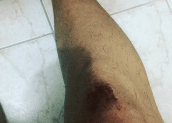 “Viado tem que morrer”. Estudante Gay Agredido por Motorista de Ônibus no RJ