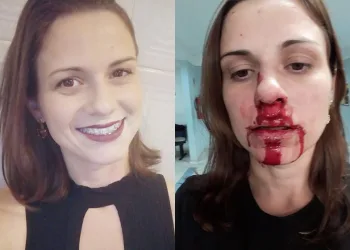 Jovem posta foto com rosto ensanguentado para denunciar agressão do ex