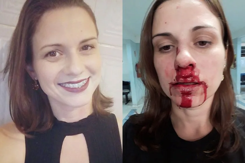 Jovem posta foto com rosto ensanguentado para denunciar agressão do ex