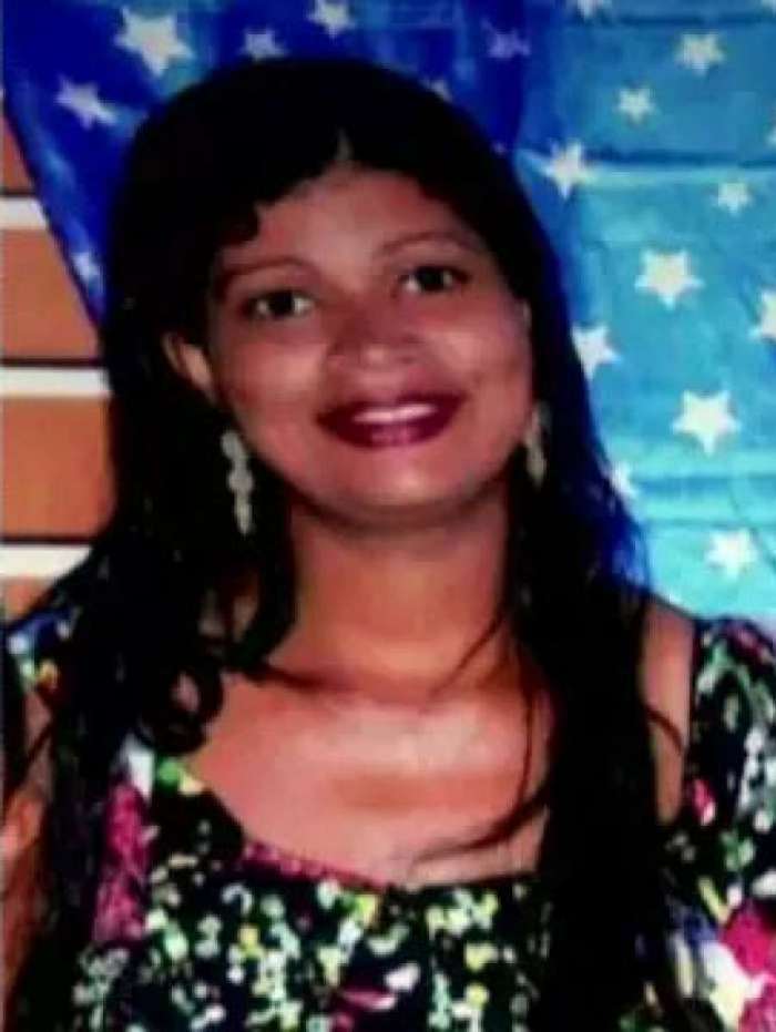 Mulher é baleada na cabeça por policiais militares no RJ