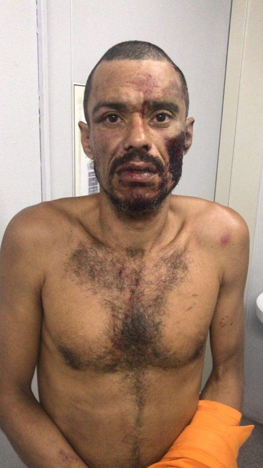 LADRÃO É PRESO ROUBANDO ÔNIBUS EM BAIRRO NA ZONA OESTE E RECEBE MUITOS CARINHOS!!