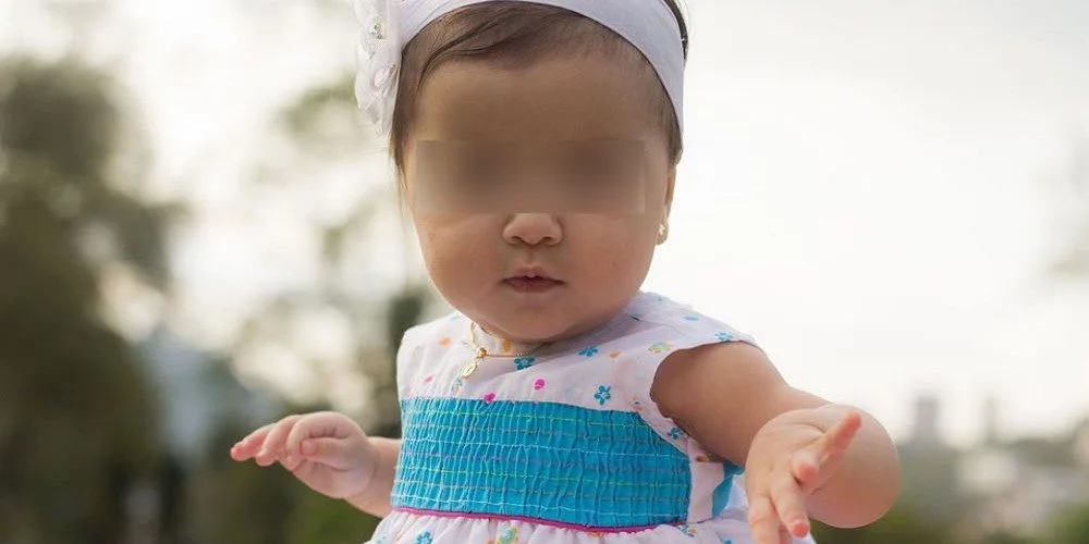 Colocar faixa de cabelo em bebês pode deixar seu filho muito doente, afirma médico