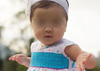 Colocar faixa de cabelo em bebês pode deixar seu filho muito doente, afirma médico