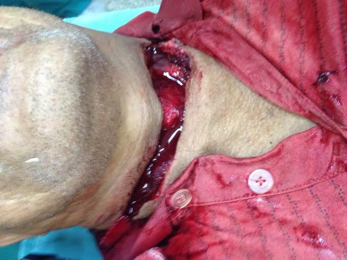 VOCÊ CONTRA OU A FAVOR DO CEROL?? MOTOCICLISTAS SE UNEM CONTRA O USO!!