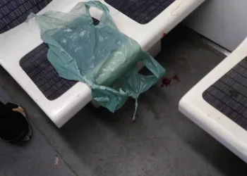 Jovem é atingido por bala perdida dentro do trem em Bairro da Zona Oeste!!