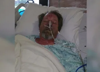 Homem tem pernas amputadas após ser lambido por cachorro