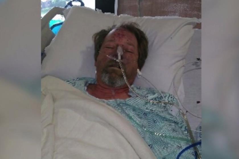 Homem tem pernas amputadas após ser lambido por cachorro