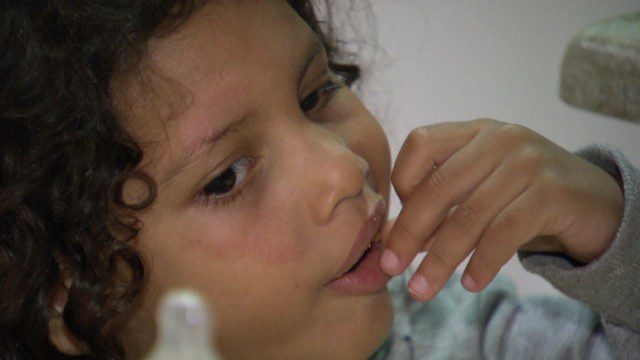 Criança atropelada e não socorrida por taxista pode perder parte da visão; família faz ‘vaquinha’ para cirurgia