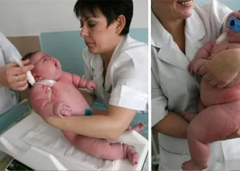 Mulher com 270 Kg dá à luz bebê de mais de 18Kg, Veja!!