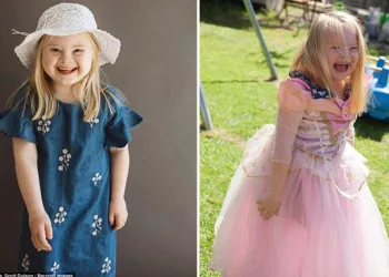 Menina Down constrói carreira de sucesso como modelo