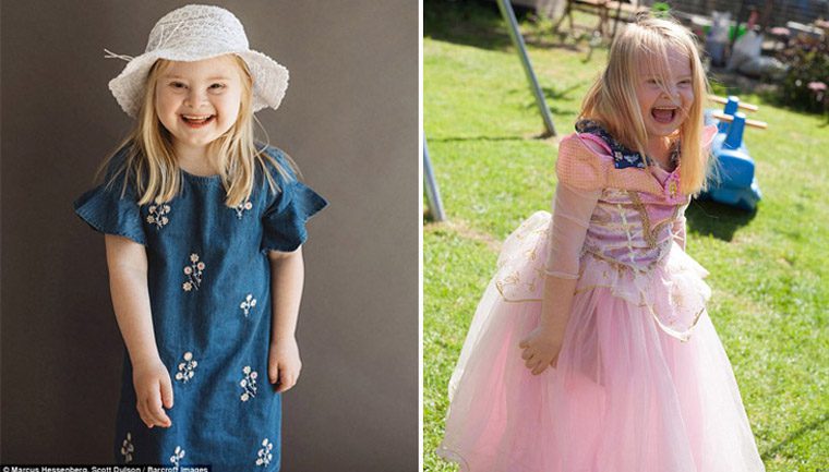 Menina Down constrói carreira de sucesso como modelo