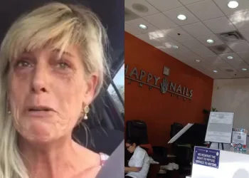 Mulher Afirma Que Foi Humilhada Em Salão Porque Tem Lúpus