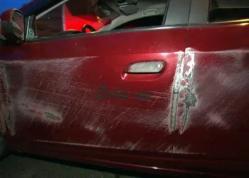 Estudante sequestrado e atingido durante tiroteio na rj, tem braço amputado